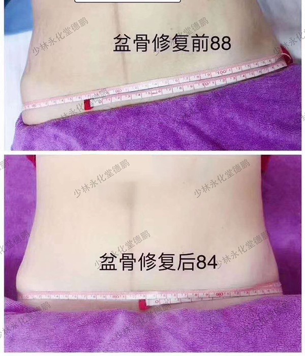   ���������îa���Ŀ-�����ޏ�